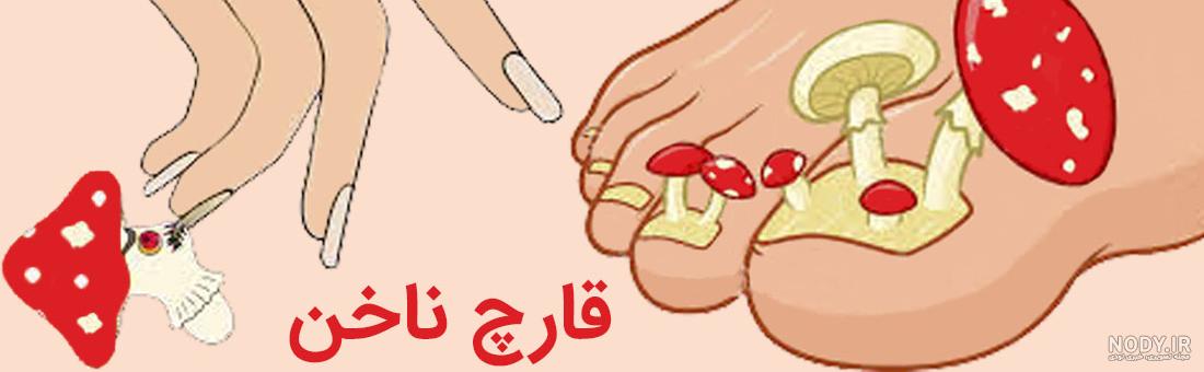 تجربه کاشت ناخن نی نی سایت تجربه کاشت ناخن نی نی سایت