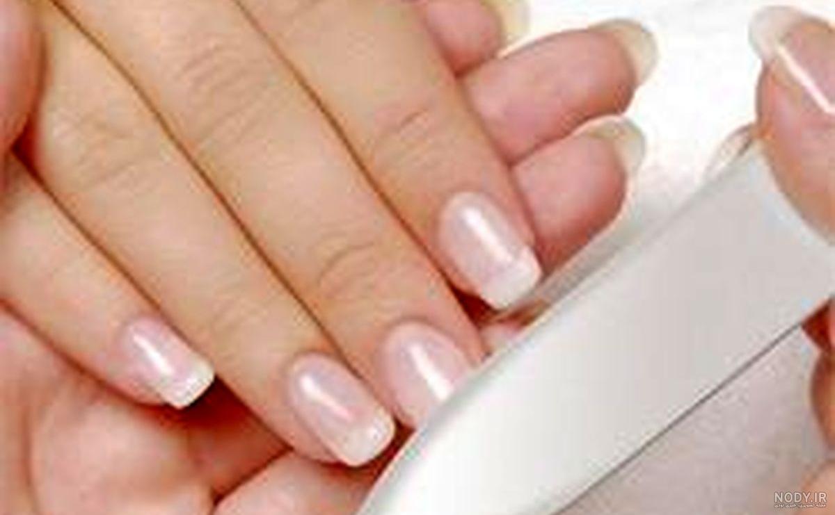 حساسیت به کاشت ناخن نی نی سایت حساسیت به کاشت ناخن نی نی سایت