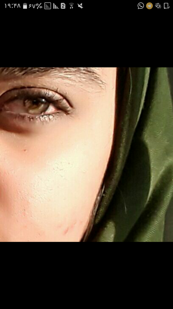 عکس چشم بادامی