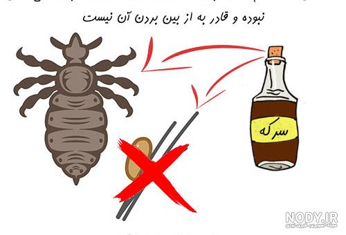 فیلم از بین بردن شپش سر فیلم از بین بردن شپش سر