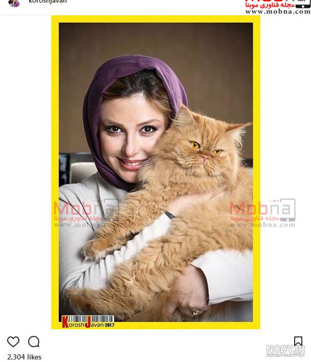 پروتز لب نیوشا ضیغمی پروتز لب نیوشا ضیغمی