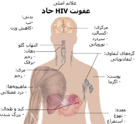 ایدز چیست و چگونه به وجود می آید