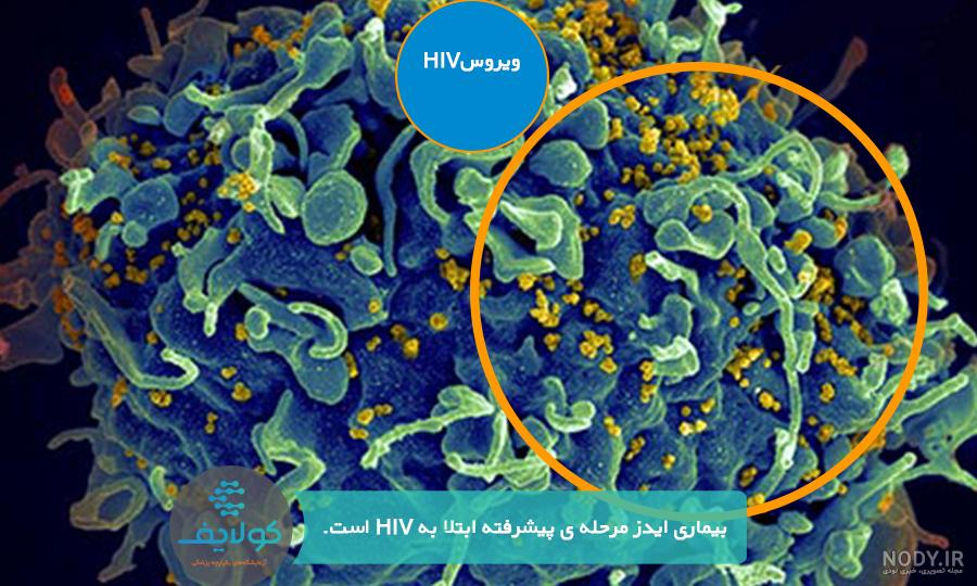 ایدز چیست و چگونه منتقل میشود