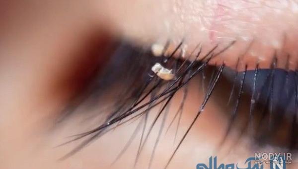 برای از بین بردن شپش سر بچه چه باید کرد برای از بین بردن شپش سر بچه چه باید کرد