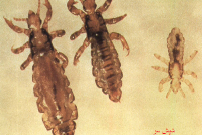 دشمن شپش چیست دشمن شپش چیست