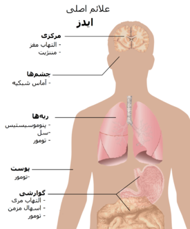 علائم ایدز بعد از چند روز