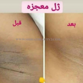 عوارض کرم روشن کننده سروینا عوارض کرم روشن کننده سروینا