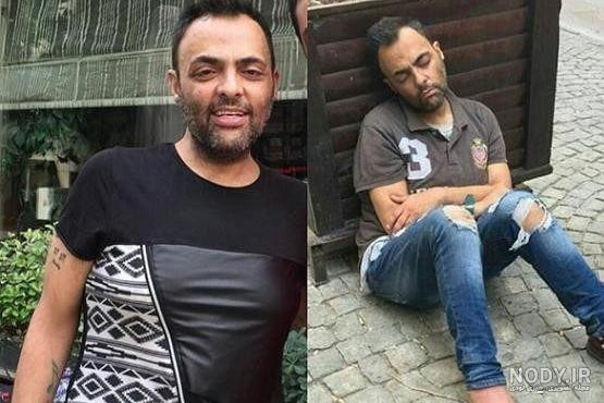 عکس شهرام کاشانی در بیمارستان