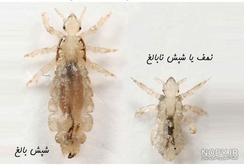 عکس شپش سیاه عکس شپش سیاه
