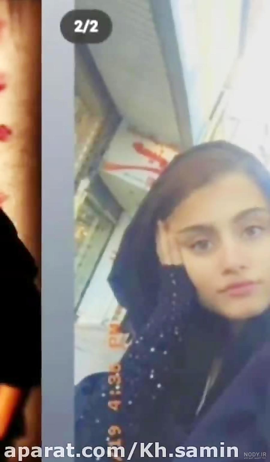 عکس قبل از عمل طاها بهمنی