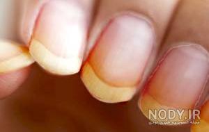 ژلیش ناخن طبیعی دخترانه ژلیش ناخن طبیعی دخترانه