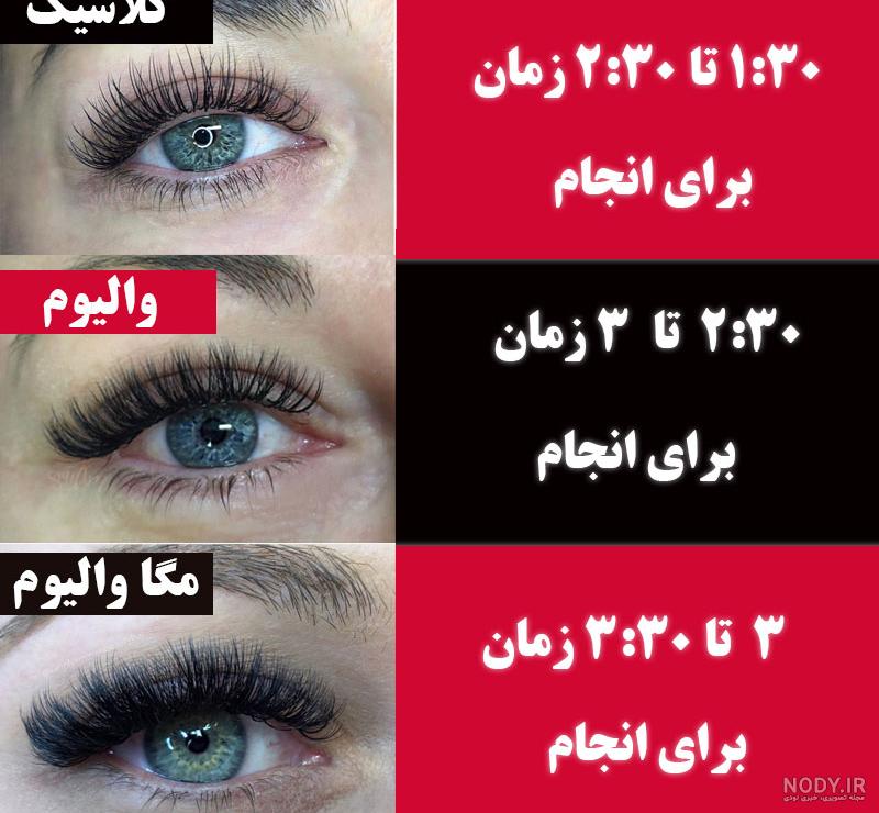 کاشت مژه عروسکی