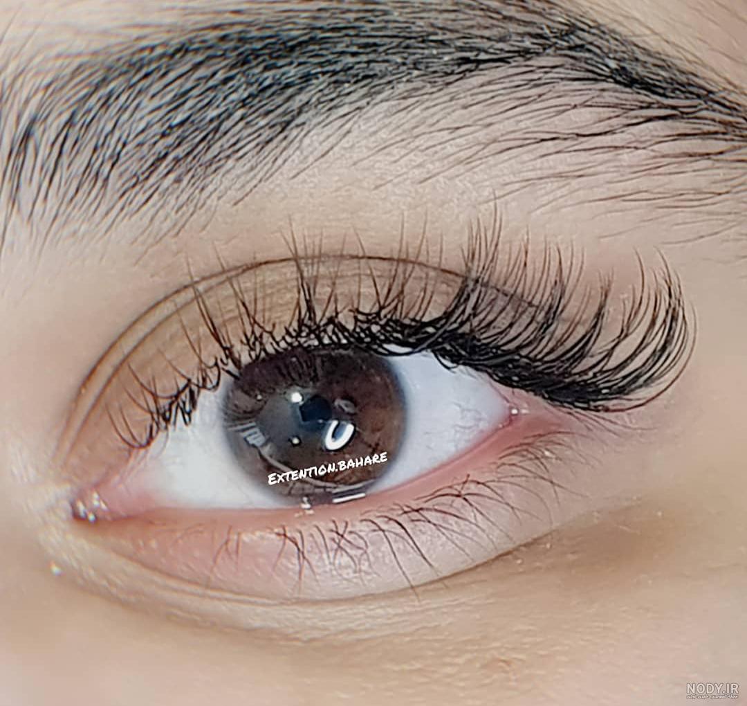کاشت مژه مدل سنجابی