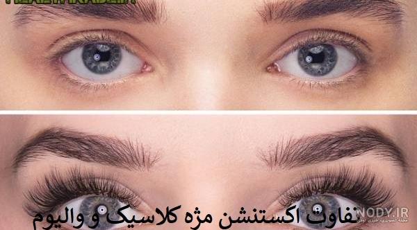 کاشت مژه والیوم نی نی سایت