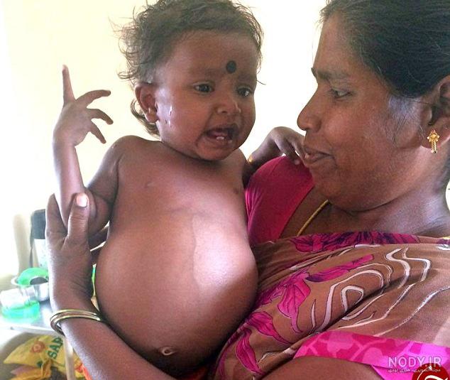 عکس نوزاد دختر هنگام تولد