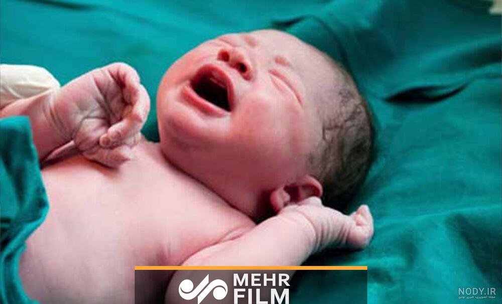 عکس نوزاد دختر یک روزه