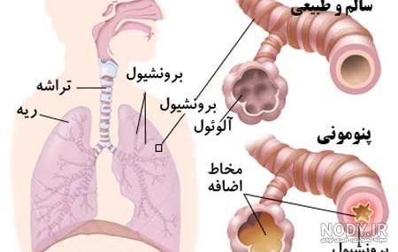 پارانشیم چیست پارانشیم چیست