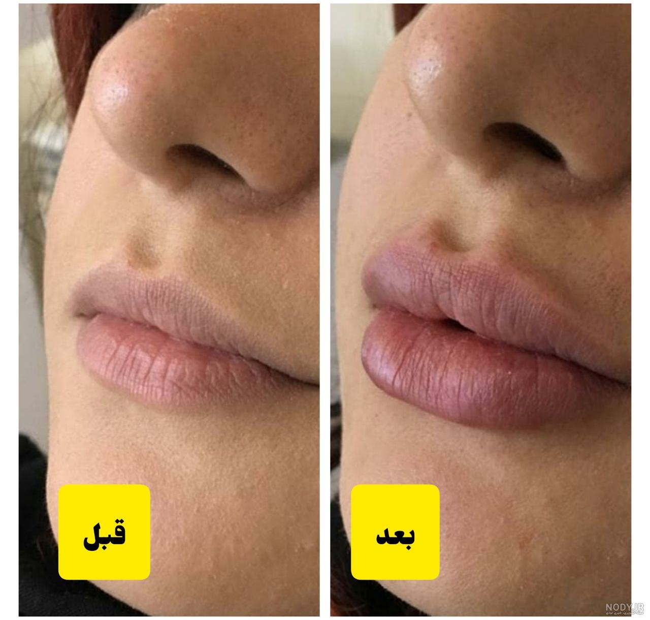 عکس لب تو لب لاکچری عکس لب تو لب لاکچری