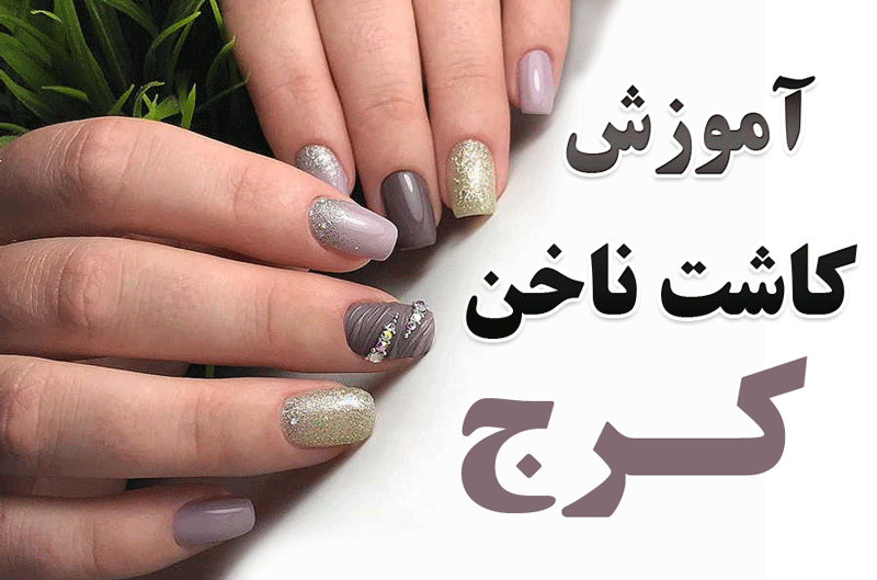 طرح کاشت ناخن