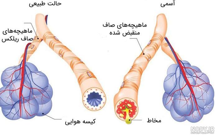 عکس رادیولوژی ریه کرونایی عکس رادیولوژی ریه کرونایی