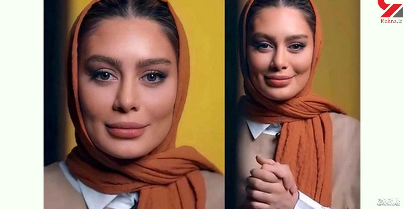 عکس سحر قریشی قبل از عمل بینی عکس سحر قریشی قبل از عمل بینی