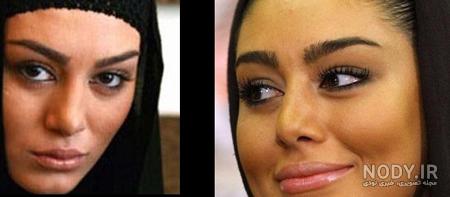 عکس های سحر قریشی بعد از عمل بینی عکس های سحر قریشی بعد از عمل بینی