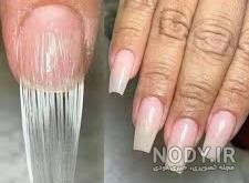 عکس کاشت فیبر