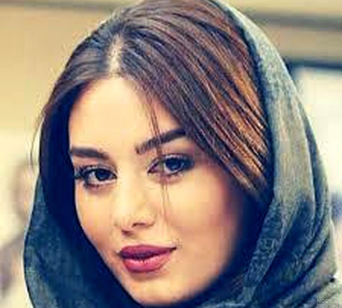 قبل و بعد عمل بازیگران ترکیه قبل و بعد عمل بازیگران ترکیه