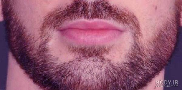 مدل ریش برای صورت لاغر