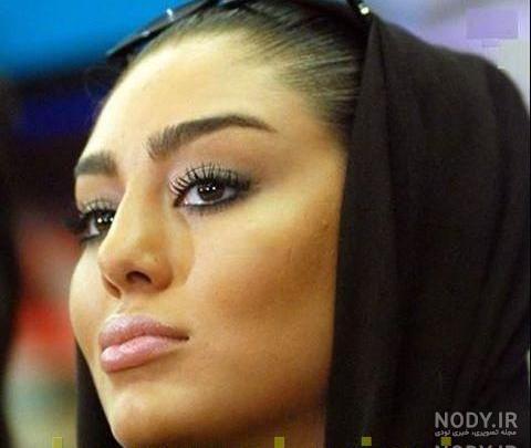 نام دکتر جراح بینی کتایون ریاحی نام دکتر جراح بینی کتایون ریاحی