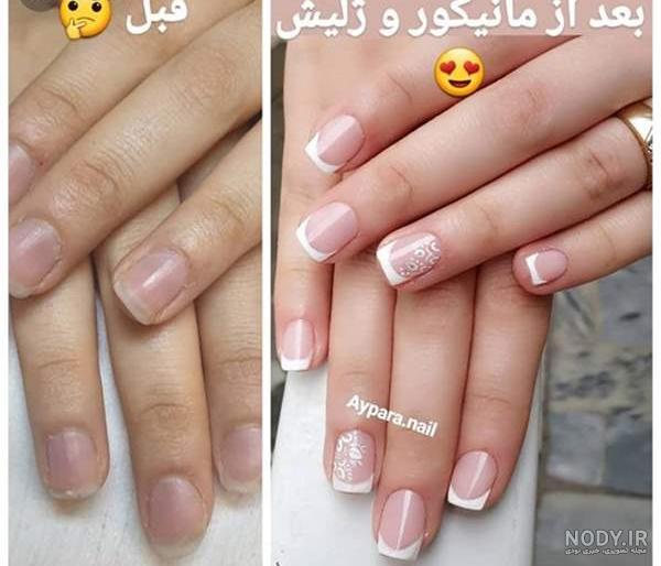 کاشت ناخن کوتاه طبیعی دخترانه