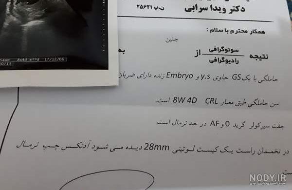 ضربان قلب بالا و جنسیت جنین نی نی سایت ضربان قلب بالا و جنسیت جنین نی نی سایت