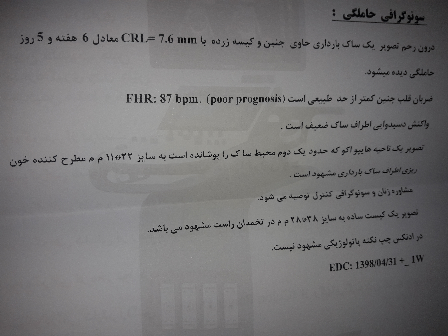 ضربان قلب جنین 170 نی نی سایت ضربان قلب جنین 170 نی نی سایت