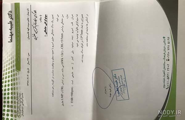 ضربان قلب جنین دختر ضربان قلب جنین دختر
