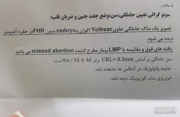 ضربان قلب جنین ۱۷۵ نی نی سایت ضربان قلب جنین ۱۷۵ نی نی سایت