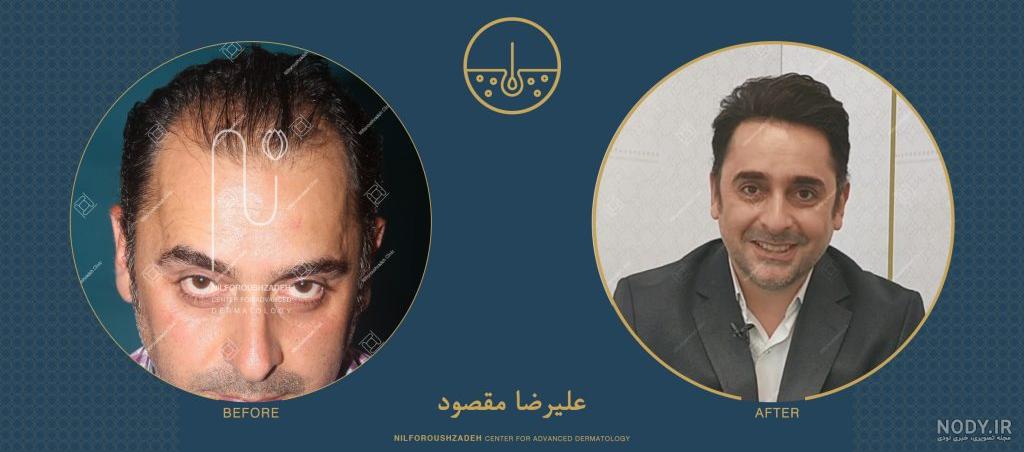 احسان علیخانی و همسرش آزاده نامداری