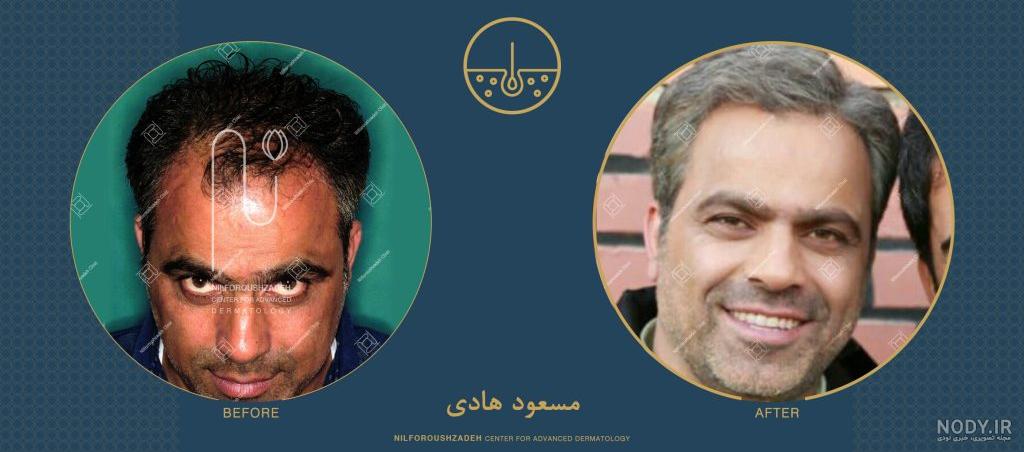 احسان علیخانی و همسرش اینستاگرام