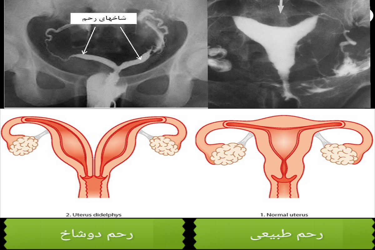 برنامه پشت عکس رنگی کن