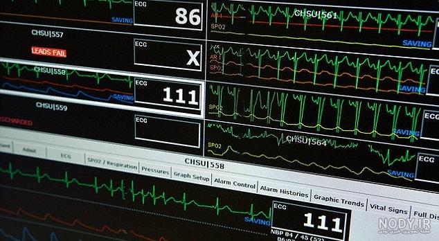 دستگاه ضربان قلب و اکسیژن خون دستگاه ضربان قلب و اکسیژن خون