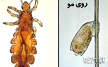 طول عمر شپش سر