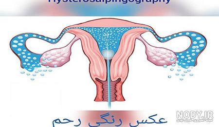 عکس رنگهای کنفی