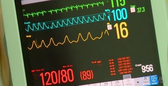 عکس ضربان قلب روی دستگاه عکس ضربان قلب روی دستگاه