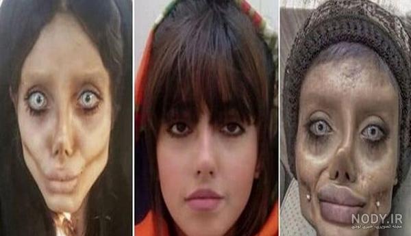 عکس واقعی سحر تبر قبل از عمل عکس واقعی سحر تبر قبل از عمل
