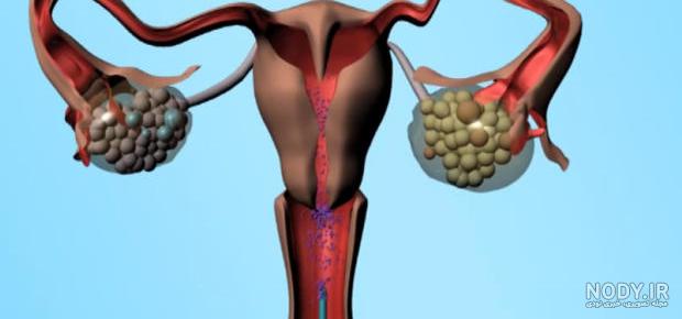 عکس کنتراست رنگی