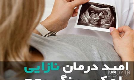 عکس گنجشک رنگی