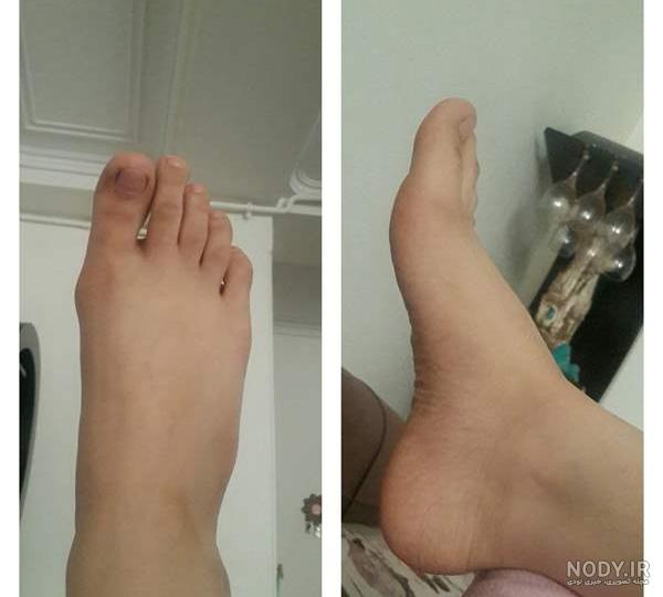 پای خوشگل نی نی سایت