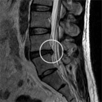انواع mri کمر انواع mri کمر