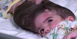 برای چند قلو زایی چی بخوریم