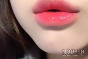 تزریق ژل لب مدل قلوه ای تزریق ژل لب مدل قلوه ای