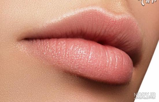 تزریق ژل لب مدل چاک دار تزریق ژل لب مدل چاک دار